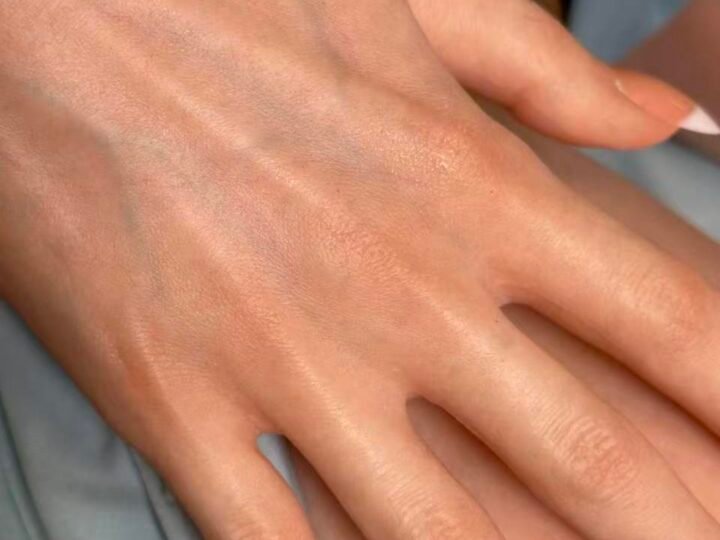 Soft Robotic Skin